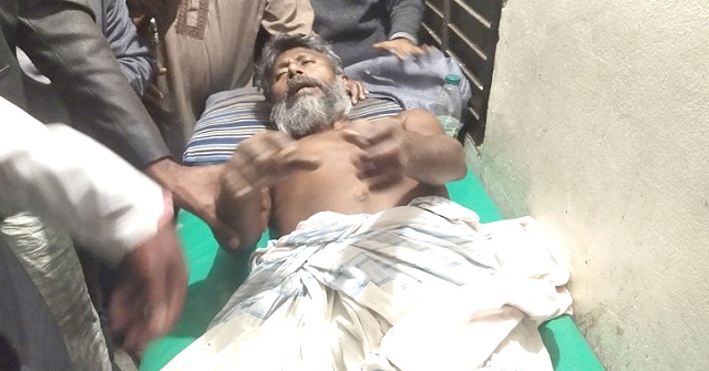 পটুয়াখালীতে  ইউপি চেয়ারম্যানের পা থেঁতলে দিয়েছে দুর্বৃত্তরা