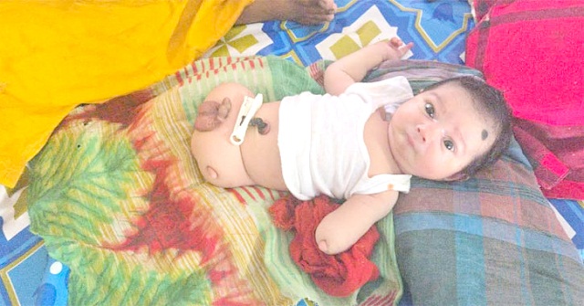 পিরোজপুরে হাত-পা বিহীন শিশুর জন্ম, গ্রহণ করতে পিতার অস্বীকৃতি