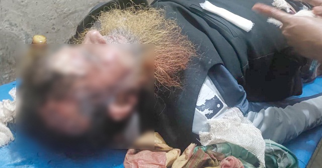 কাজিরহাটে বিএনপি কর্মীদের হামলায় ৬ জামায়াতকর্মী আহত