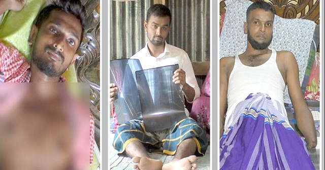 টাকার অভাবে চিকিৎসা বন্ধ আন্দোলনে গুলিবিদ্ধ ভোলার তিন যুবকের