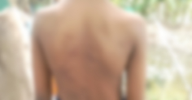 মাদরাসা ছাত্রকে পিটিয়ে জখমের অভিযোগ