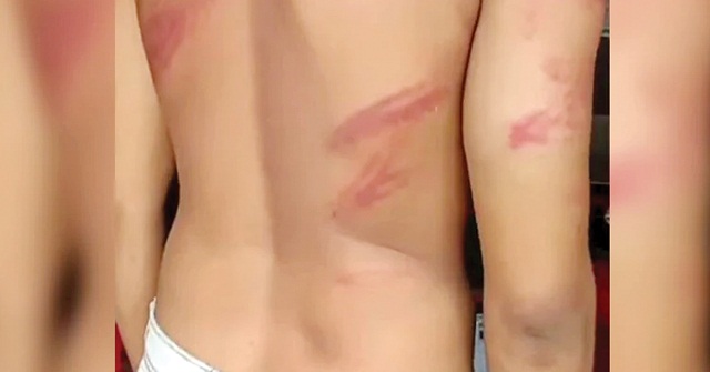 চুরির অপবাদ দিয়ে তরুণকে গাছে বেঁধে নির্যাতন