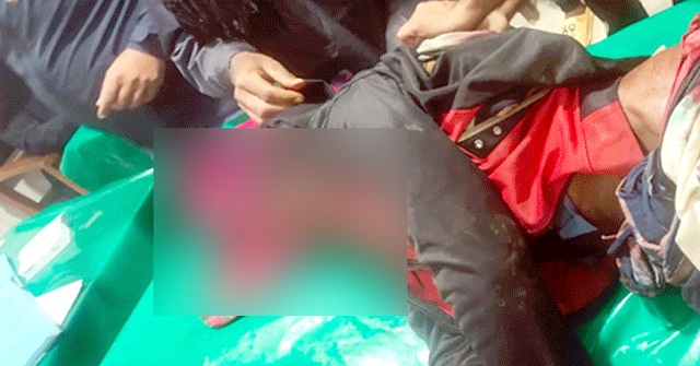 নাজিরপুরে নৌকার সমর্থককে কুপিয়ে জখম