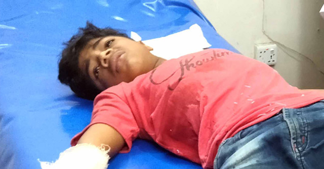 আগৈলঝাড়ায় পটকা তৈরি করতে গিয়ে শিশু আহত