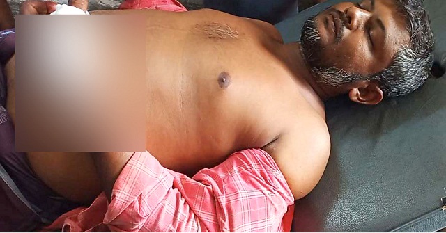 মঠবাড়িয়ায় জমিজমা সংক্রান্ত বিরোধে হামলায় আহত ৩
