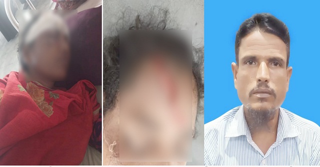 ভাবির কপাল ফাটালো দেবর 