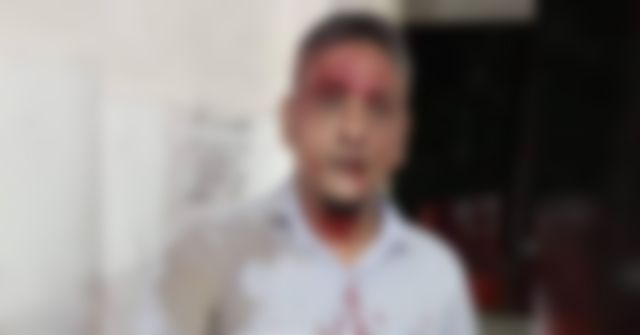বানারীপাড়ায় সন্ত্রাসী তপু বাহিনীর হামল‍ায় আহত ব্যবসায়ী 